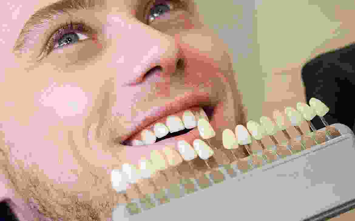 procedure3